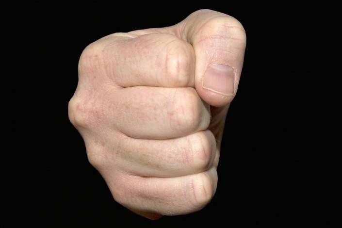 Liepājā vīrietim kautiņā salauž žokli un degunu