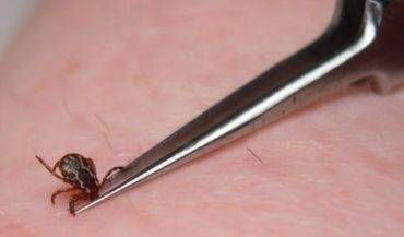 Latvijas Infektoloģijas centrā noņem pirmo piesūkušos ērci