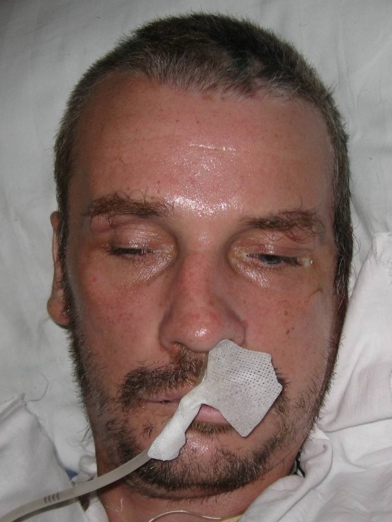 FOTO: Policija lūdz atpazīt smagi cietušu vīrieti