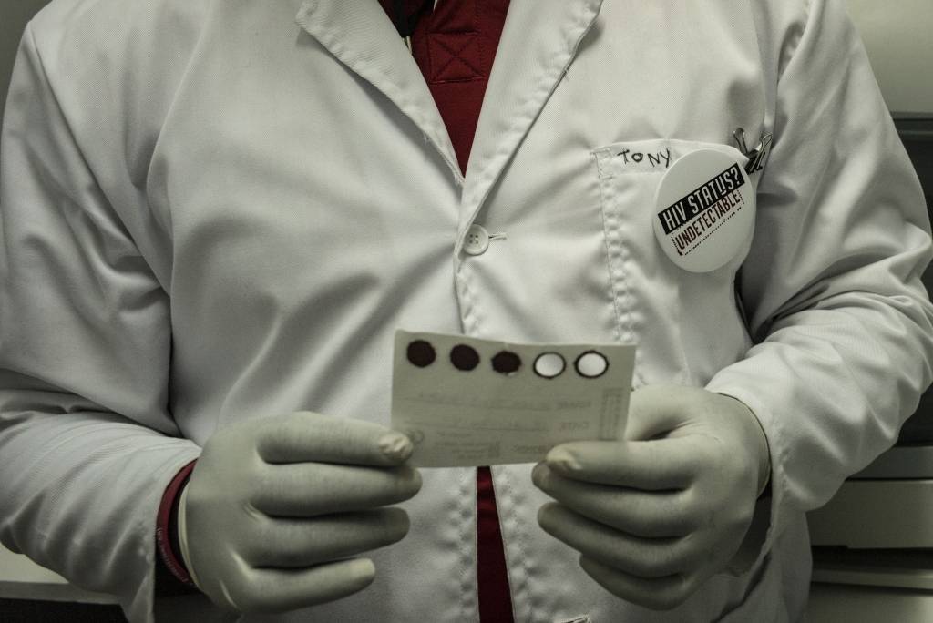 Pētījums: HIV kļūst mazāk bīstams