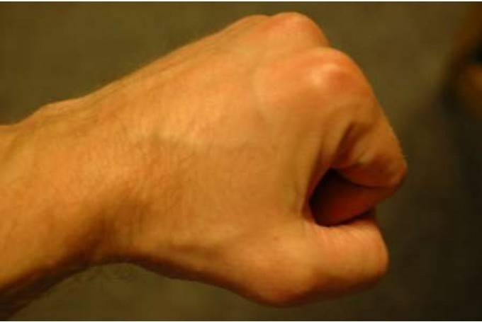 Konflikta laikā vicina dūres un nozog somu ar dokumentiem