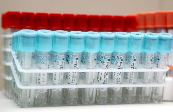 Medicīniskās analīzes - precīzākas un ātrāk