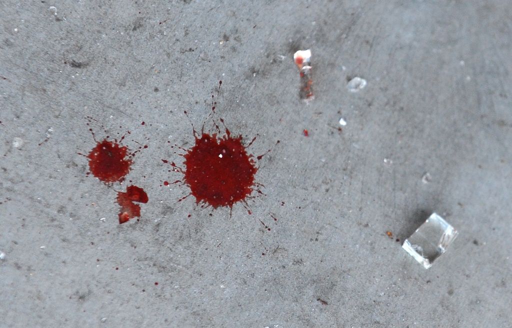 Traģisks negadījums: Dzērājšoferis sabrauc velosipēdisti