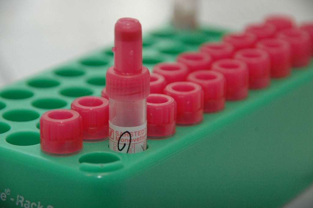 Diabēta biedrība piedāvā bezmaksas cukura un holesterīna analīzes