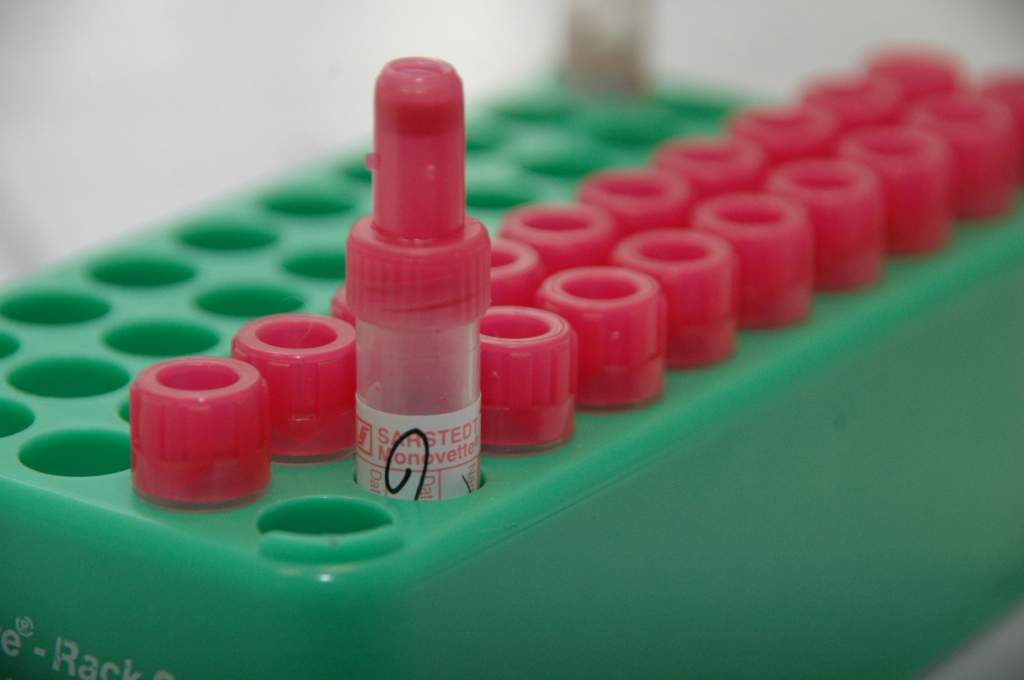 Liepājas Leļļu teātrī notiks Asinsdonoru diena