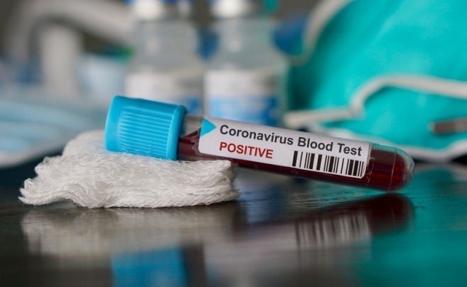 Pēdējā diennaktī lielākais Covid-19 konstatēto gadījumu skaits - 15 jauni pacienti, kopumā Latvijā saslimuši 49