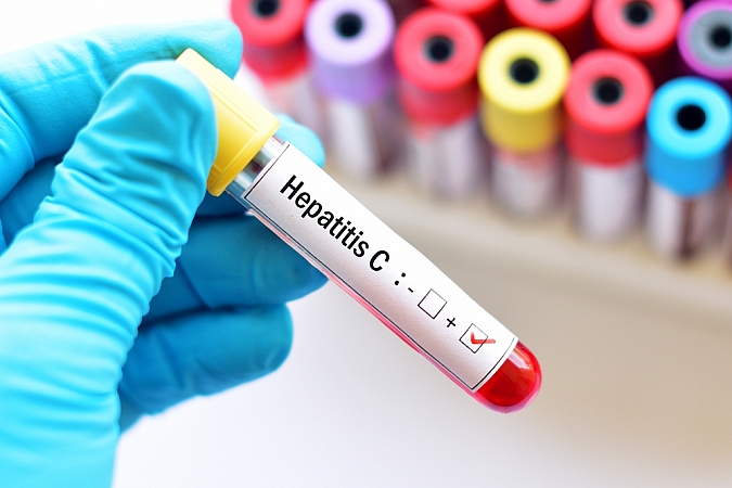 Pasaulē tiek atzīmēta C hepatīta diena