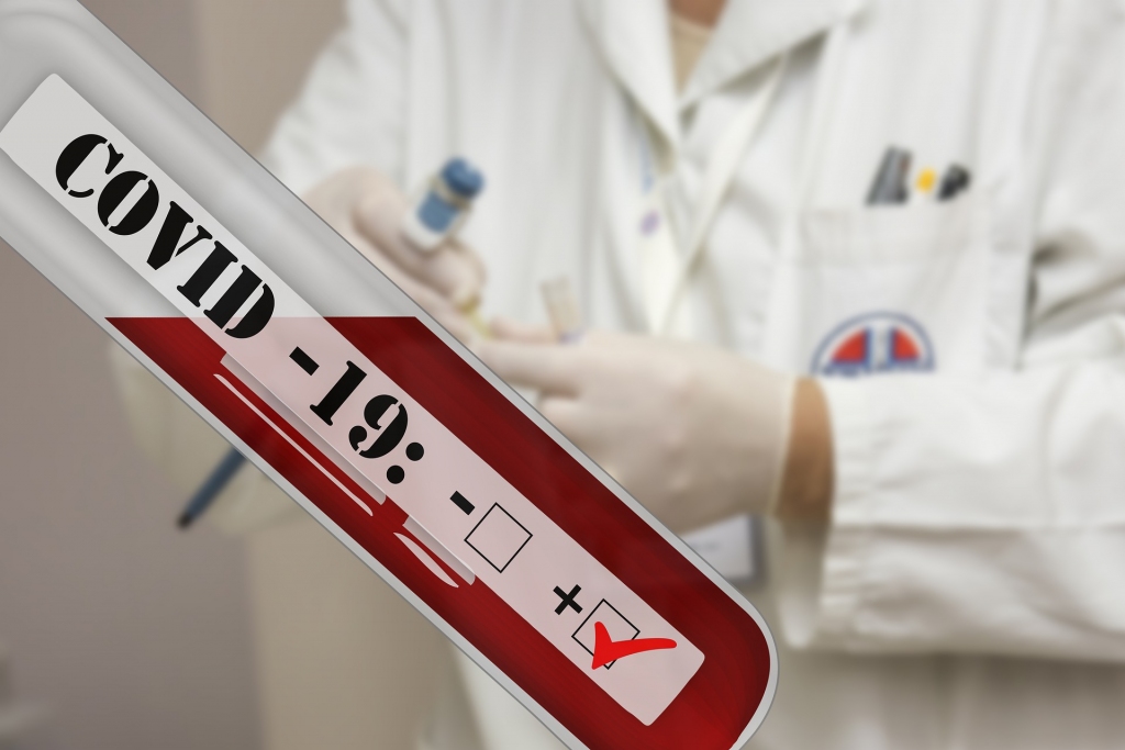 Svētdien Latvijā atklāti 178 Covid-19 gadījumi un divi sasirgušie miruši